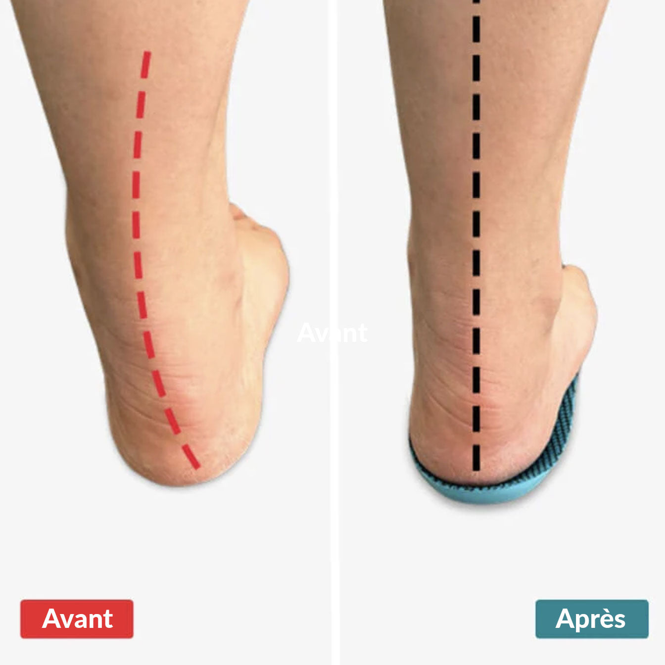 SteppyConfort - Semelles orthopédiques